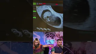 H3H3Productions Baby Update!!