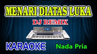 Menari Diatas Luka Remix Karaoke Imam S Arifin HD Audio Nada Pria