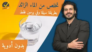 التخلص من الماء الزائد بالجسم في يومين بدون ادوية_اسبابه وعلاجه الفعال والسريع