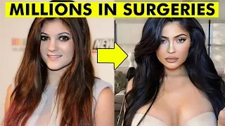 10 Celebrity Transformations You Would Never Believe