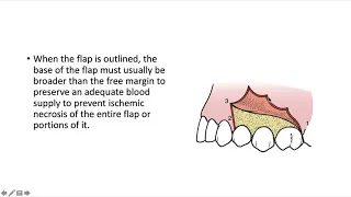 PRINCIPLES OF INTRAORAL FLAP DESIGN FOR SURGICAL EXTRACTION