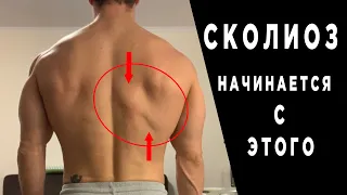 Исправь ЭТО или начнётся СКОЛИОЗ!!!