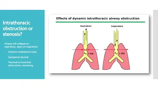 Anesthesia Considerations in the Narrowed Airway:  Jet Ventilation and Rigid Bronchoscopy