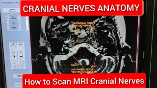 Cranial Nerves Anatomy and Physiology
