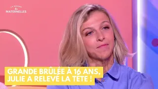 Grande brûlée à 16 ans, Julie a relevé la tête ! - La Maison des maternelles #LMDM