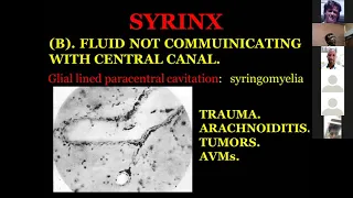 JORDAN GRAND ROUNDS Mar 2019 "Chiari Malformation" with Ibrahim Sbieh MD