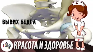 Вывих бедра