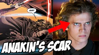 How Anakin Skywalker got his scar… (Star Wars Explained)