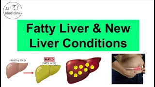 Fatty Liver (NAFLD) & “New” Liver Conditions | MASLD, MetALD & Others (Diagnostic Criteria)