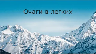 Очаги в легких