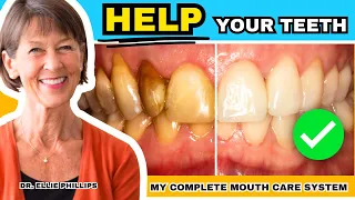 How To Create Healthy Teeth - My Complete Mouth Care System (Step-by-Step)