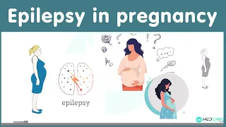 Epilepsy in pregnancy: Causes, Risks and management
