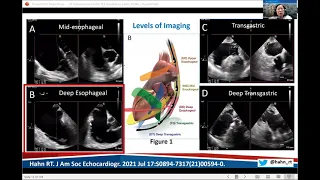 Part 1: Introduction to the Guidelines and Review of Aortic and Mitral Imaging