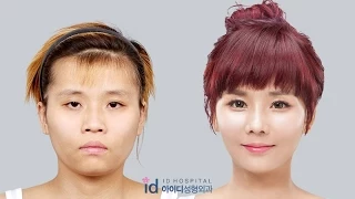 [ID Hospital Review] Korea plastic surgery before and after, Let me in Season 4 Eng Sub