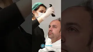 Hair Transplant Surgery in Istanbul 2023