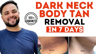 Dark NECK,Knee & Elbow Treatment in 7 Days ||Body Polishing at Home