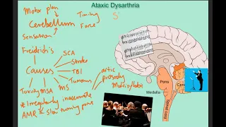 Ataxic dysarthria - samples and explanation