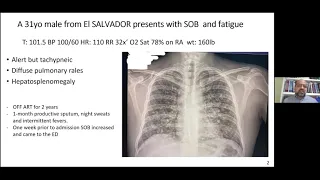 Making Sense of the COVID-19 Data in Persons with HIV