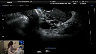 TUTORIAL DE DOPPLER EM GINECOLOGIA, VIA TRANSVAGINAL - VOL. 1 - 1 EXAME