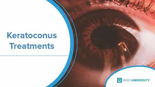 Current Treatments of Keratoconus: What You Need To Know