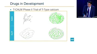 Essential Tremor: HSS