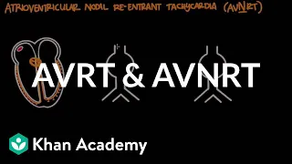 Atrioventricular reentrant tachycardia (AVRT) & AV nodal reentrant tachycardia (AVNRT)