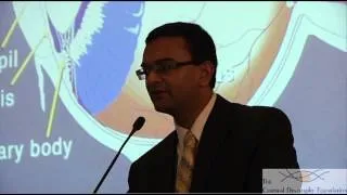 Sanjay V Patel, MD, Chairman of Ophthalmology, Mayo Clinic, Rochester, MN