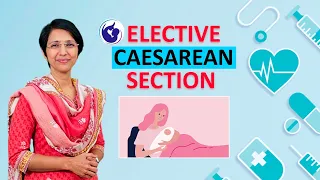 What is Elective C Section (Cesarean section) – Dr. Rajeshwari Reddy Explains