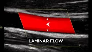 Introduction to Doppler Ultrasound