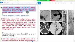 6 CENTRAL NERVOUS SYSTEM Master Pass Paper 3 Q56 to 70