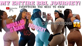 SHOULD YOU GET A BBL IN MEXICO? I DID! 😍 WOULD I DO IT AGAIN? 🥴COMPLICATIONS, RECOVERY, PROS & CONS😱