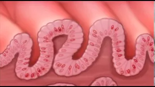 What is Barretts Esophagus?-Mayo Clinic