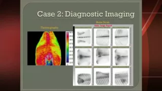 VersaTron Shock Wave -  Dr  Kent Allen Chronic Back and Sacroiliac Pain