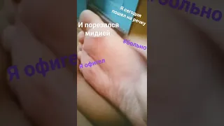 порезался