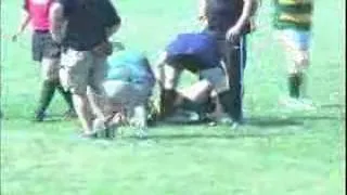 Painful Rugby Leg Break Footage