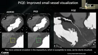 Deep Learning for CT Reconstruction – Image Denoising and Beyond