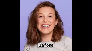 Millie bobby brown before and After Plastic surgery #strangerthings #milliebobbybrown #sadiesink