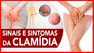 Sinais e sintomas da Clamídia