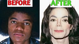The Evolution Of Michael Jackson’s Face | Plastic Surgery Analysis