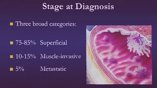 Bladder Cancer