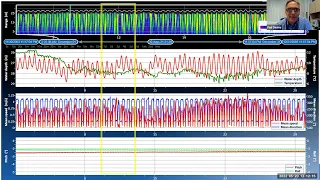 Scripps Technical Forum - Teledyne RDI - Deciphering your ADCP Data