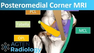 Posteromedial Corner Anatomy on Knee MRI