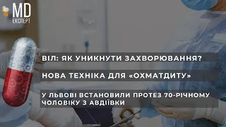 Боротьба з ВІЛ | Гінекологічні проблеми | Нове обладнання для Львівського «Охматдиту» #MDExpert