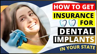 Insurance for Dental Implants in 2024 | How Much Dental Implants Cost, Medicare & Insurance