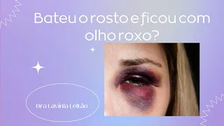 Sofreu um trauma e ficou com olho roxo? Dra Lavínia Leitão