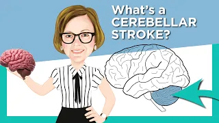 Cerebellar Stroke