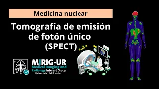 Tomografía por emisión de fotón único (SPECT) - Medicina nuclear - MIRIG-URG
