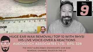 TOP 10 EAR WAX REMOVAL VIDEOS - NUMBER 9