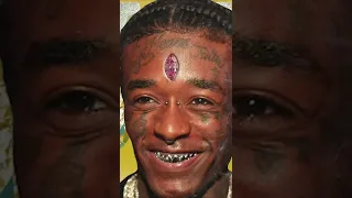 Lil Uzi Vert’s $24 Million forehead diamond ripped out #shorts