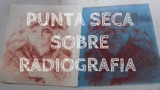 punta seca en radiografia